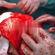 :) ـــــــــــــــــــــــــــــــــ