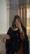 قبلا ی بیماری داشتم به اسم:نکنه ناراحت بشن 