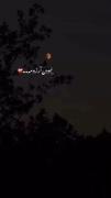 ی بغضی ت گلمومه نبودن آرزومه❤️‍🩹❤️‍🩹💔💔