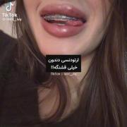 ولی ارتودنسی »»»‌‌ ‌‌‌‌‌‌‌‌‌‌‌‌‌‌‌‌.