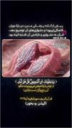 اینم یکی دیگه معجزات قرآن:)