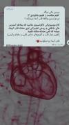 و هزار و یک باررر قلبم این حسو تجربه کرد🙃💔🫀
