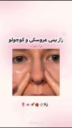 با این روش بینیت رو عروسکی کن