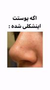 اگر پوست تون لین طوری شد این کار ها رو بکن✨🌟