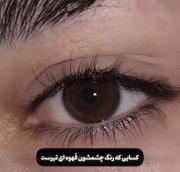 و اینه که نشون میده هرچشم چه ارزشی داره..