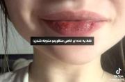چگونه خود را شکنجه کنیم........
