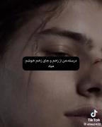 درسته من از زخم و جای زخم خوشم میاد😉