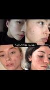 دقیقا همینه 😭 تو نظرات بنویسید اگر موافقید 