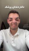 تا حالا بهش دقت کرده بودین ؟؟ 🤣🤣