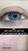 وقتی تو جمع مسخرت میکنن🥺🥹😔🥲